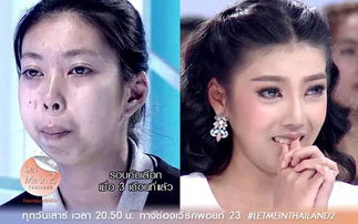 挽回整容男人的心态,变美无需心虚：重建男性整容信心