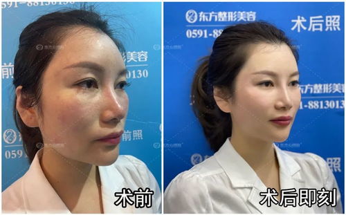 整容成功后挽回前夫,成功整容挽回前夫