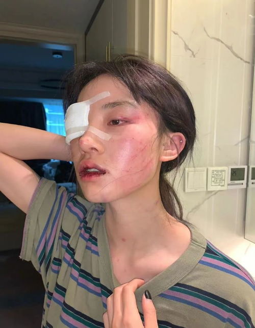 挽回女朋友怎么死皮赖脸,如何成功挽回前女友