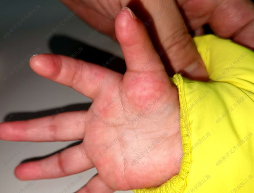 如何挽回手足情,手足深情，怎样修复？