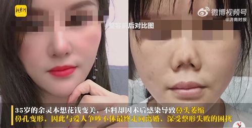 整形失败的婚姻修复挽回，救救婚姻！专家教你修复失败婚姻，让爱重燃！