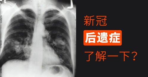 如何挽回脑梗失忆,失忆后如何恢复记忆