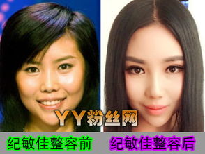 整容挽回丈夫的心,整容拯救婚姻