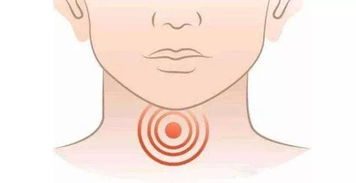 茶叶锁喉怎么挽回,如何解决喝茶后喉咙不适？