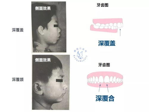nol最后挽回颜面了吗，Nol成功挽回颜面，实现逆袭？