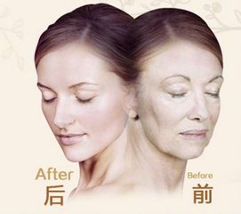 整容后为了挽回男友,挽回男友，美容手术再出发！)