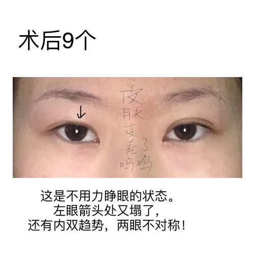 挽回颜面意思是什么,恢复尊严：重新起航