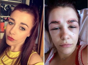 整容可以挽回前任吗,整容能否让前任复合？