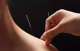 扎手指血挽回术，手指出血如何止血？小妙招分享