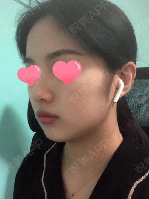 整容不为挽回变心的丈夫，换个容貌追回变心夫？