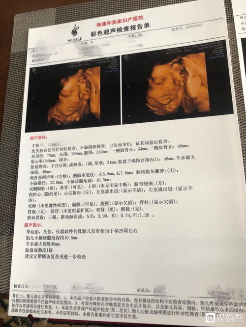 胎儿小脑偏小怎么挽回,胎儿小脑偏小如何补救