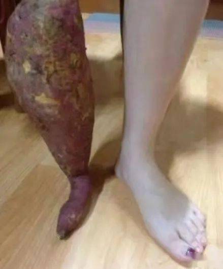 自残能挽回男友吗,自残能否挽回失去的男友