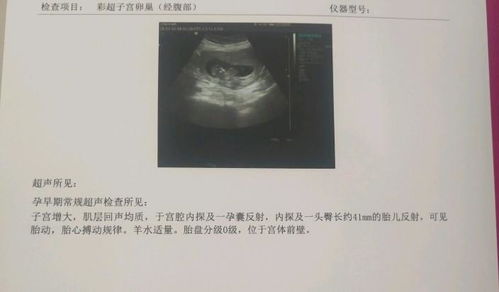 胎儿小脑偏小怎么挽回,胎儿小脑偏小如何补救