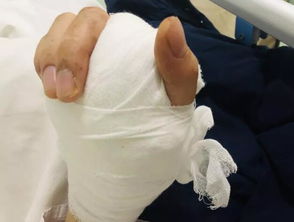 起泡胶化了怎样挽回,泡胶失控，如何抢救？