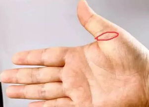 毛囊萎缩可以挽回吗,治疗毛囊萎缩，还有救吗？