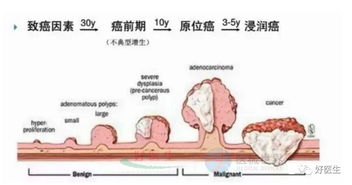 直肠男挽回对象说说，男子辛苦努力打动女神的心，是否终于得到回应？