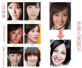 整容分手能挽回吗,整容分手还有挽回的可能吗