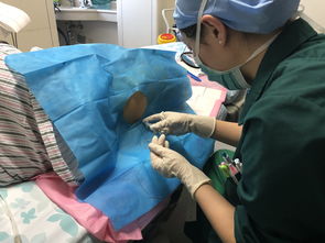 结扎能挽回吗,动物结扎后还能恢复吗？