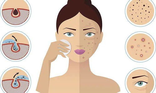 熬夜皮肤差怎么挽回,熬夜后皮肤差怎么救？