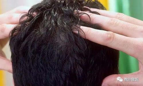 掉头发如何挽回,饮食须知：有效解决掉头发问题