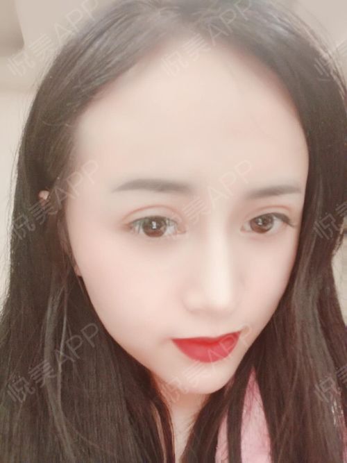 磨皮挽回颜值,美颜修复之重获颜值