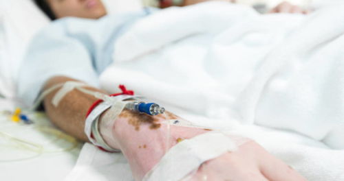 激光结扎可以挽回吗,激光结扎是否具有救治效果)